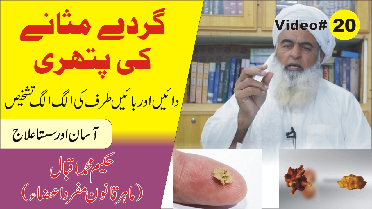 گردے کی پتھری