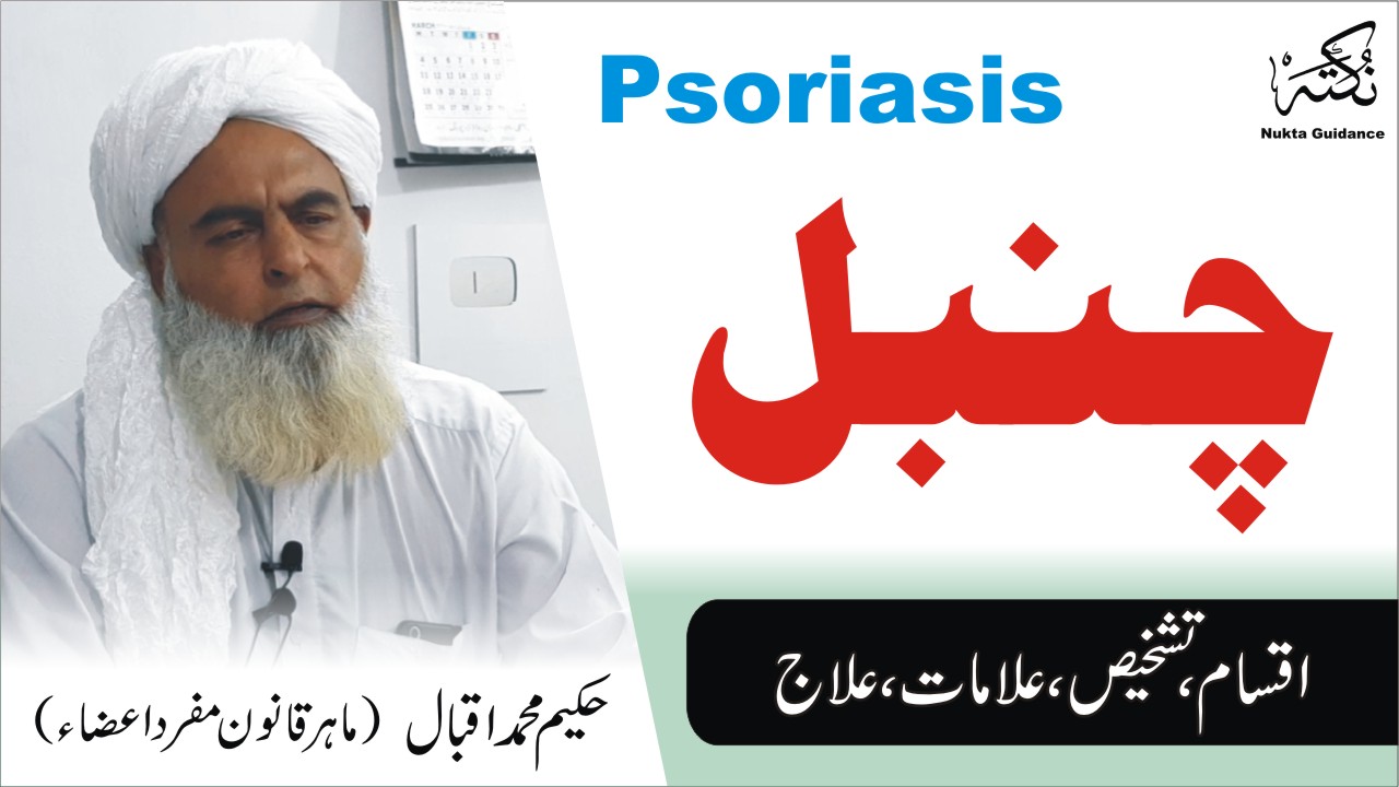 چنبل کا علاج