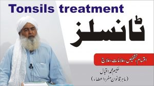 ٹانسلز کا علاج