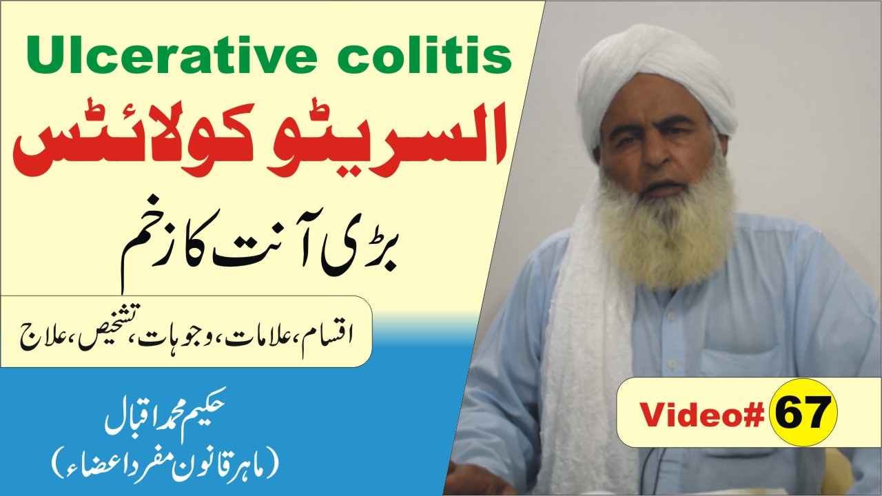 السریٹو کولائٹس || अल्सरेटिव कोलाइटिस