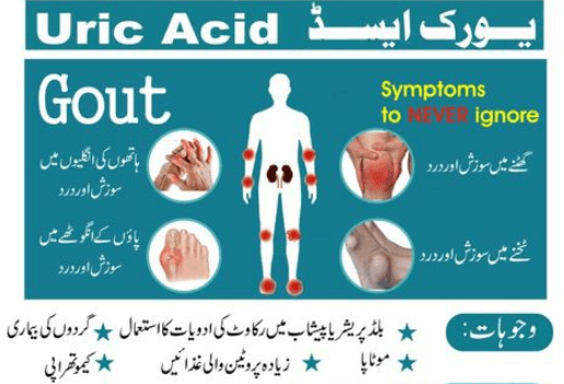 یورک ایسڈ کا گنٹھیا