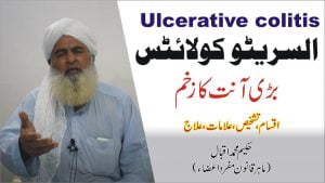 Read more about the article السریٹو کولائٹس