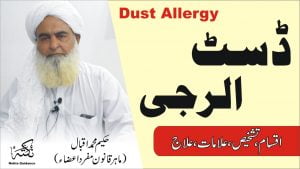 Read more about the article ڈسٹ الرجی