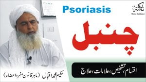 Read more about the article چنبل کا علاج