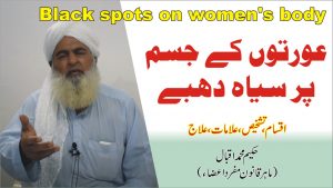 Read more about the article عورتوں کے جسم پر سیاہ دھبے