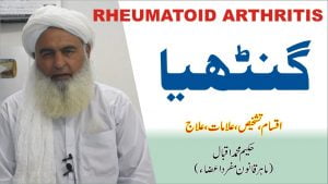 Read more about the article گنٹھیا کا علاج