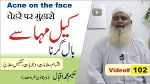 Read more about the article کیل مہاسے چھائیاں