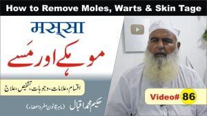 Read more about the article موہکے مسے