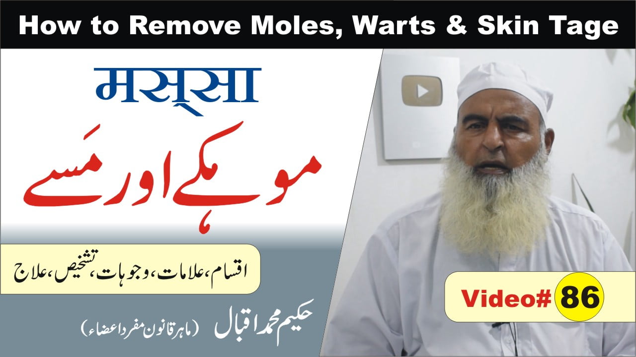 86 Wart मस्सा मस्सा Mohkay Massay 10