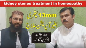 Read more about the article گردے کی پتھری ہومیوپیتھی میں علاج