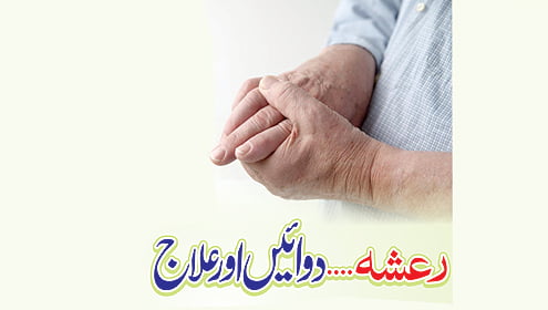 رعشہ فالج لقوہ 1