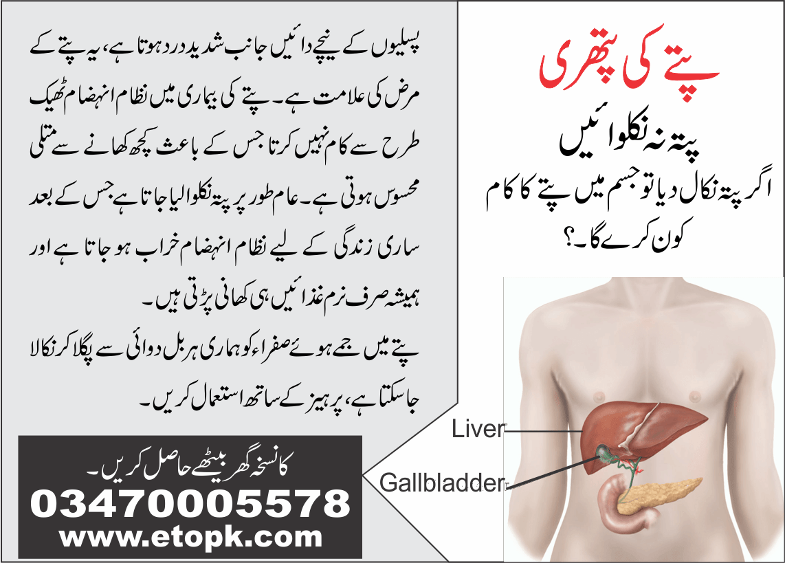 gallbladder stone پتے کی پتھری 27