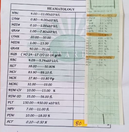 لیبارٹی ٹیسٹ 7