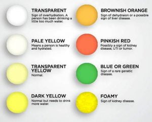 Urine color and health 1