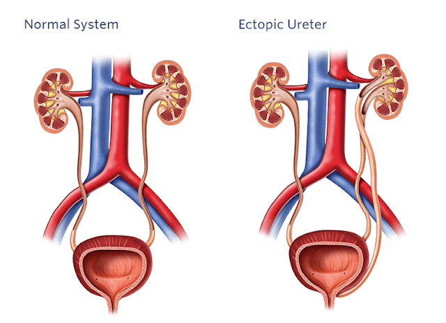 پیشاب قطرے 5