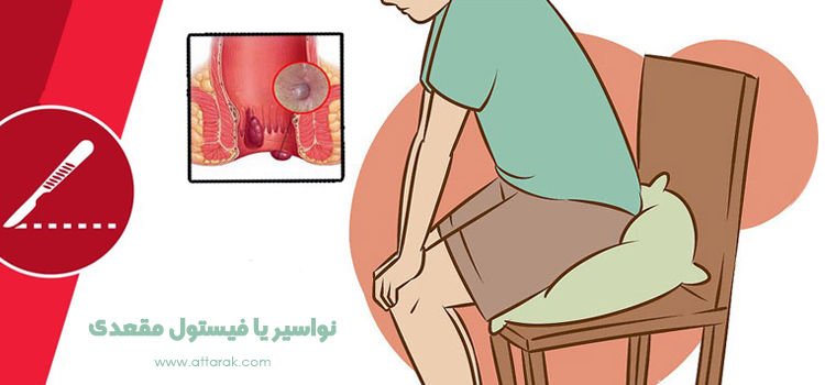 navasir attarak photo نواسیر 3