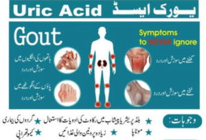 Read more about the article یورک ایسڈ کا گنٹھیا